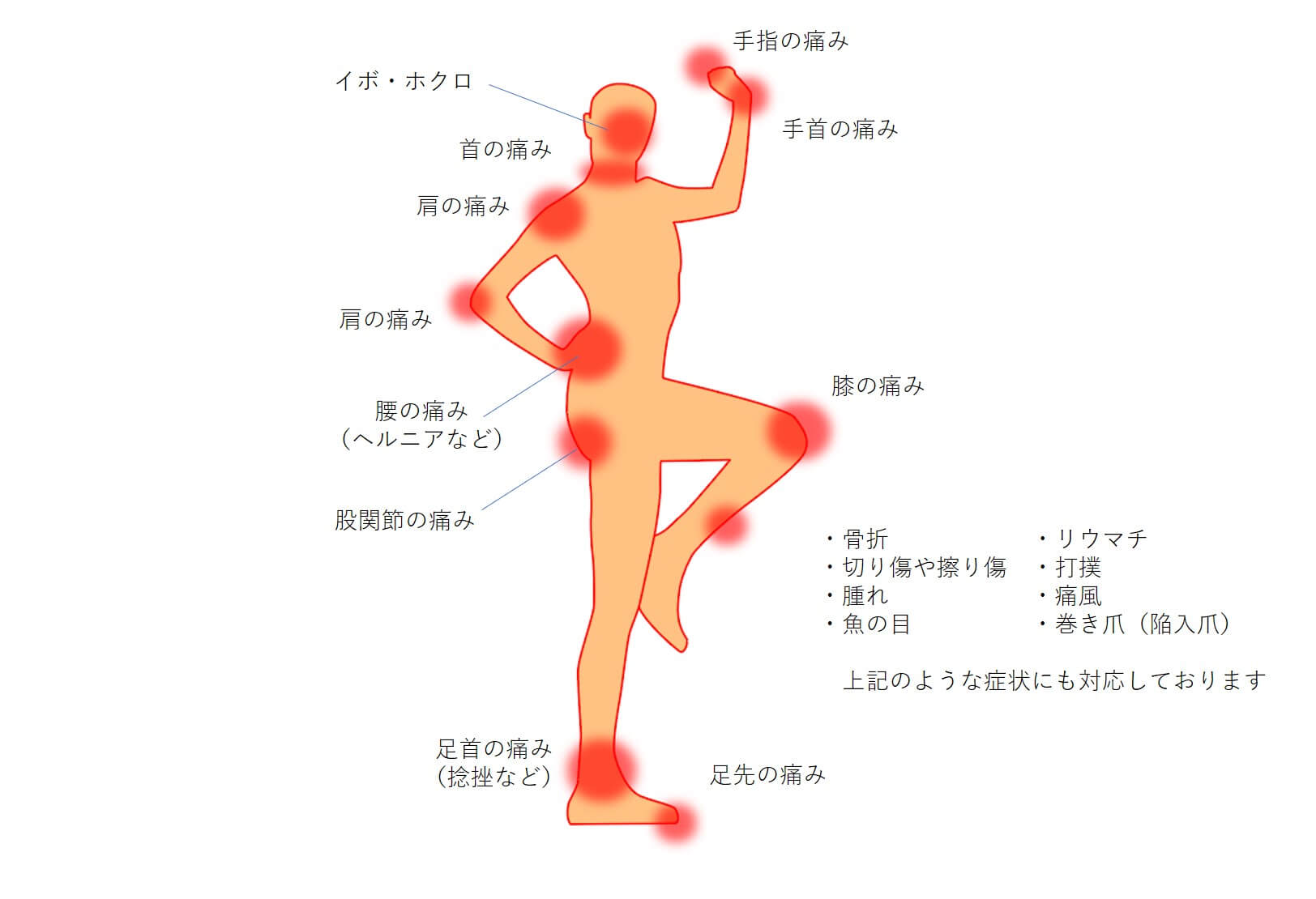 整形外科対応箇所
