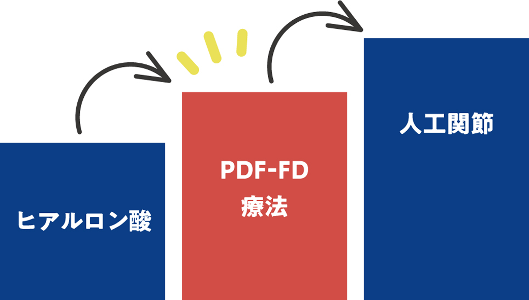 ヒアルロン酸と人工関節の中間に位置する新しい選択肢のイメージ