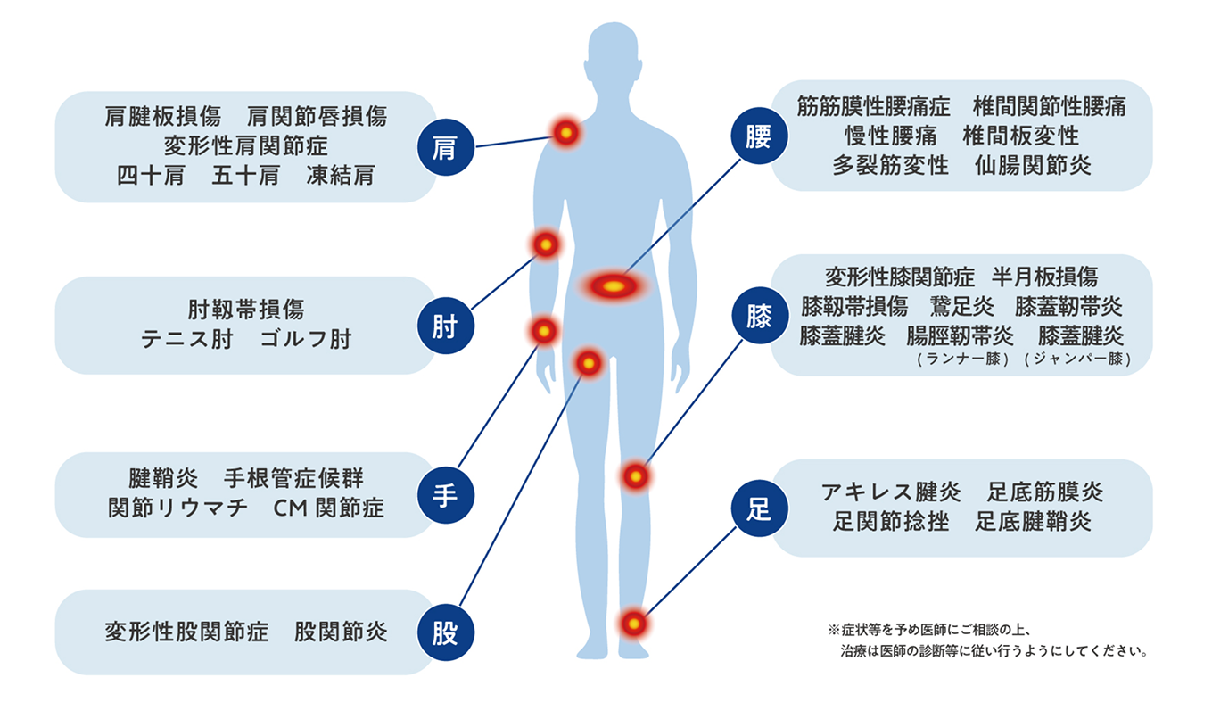 肩：肩腱板損傷、肩関節唇損傷、変形性肩関節症、四十肩、五十肩、凍結肩。腰：筋膜性腰痛症、椎間関節性腰痛、慢性腰痛、椎間板変性、多裂筋変性、仙腸関節炎。肘：肘靭帯損傷、テニス肘、ゴルフ肘。膝：変形性膝関節症、半月板損傷、膝靭帯損傷、鷲足炎、膝蓋靭帯炎、膝蓋腱炎、鵞足炎（ランナー膝）、ジャンパー膝。手：腱鞘炎、手根管症候群、関節リウマチ、CM関節症。足：アキレス腱炎、足底筋膜炎、足関節捻挫、足底腱鞘炎。股：変形性股関節症、股関節炎。